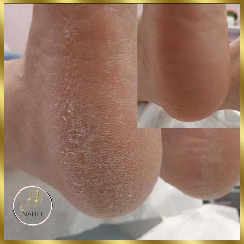 گالری پدیکور